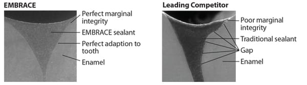 Embrace™ WetBond™ Pit & Fissure Sealant