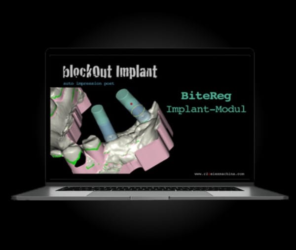 Additional module BiteReg Implant 1490 1509 – Baumann Dental, Software