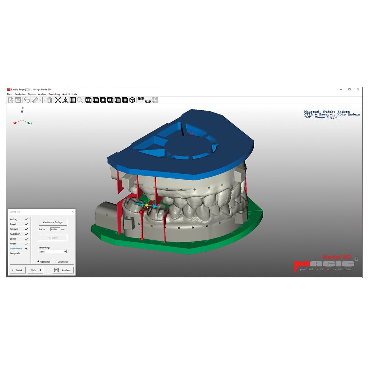 Magic Model 3D, Dental CAD-Modelbuilder inkl. Dongle – Baumann Dental, CAD/CAM-Software