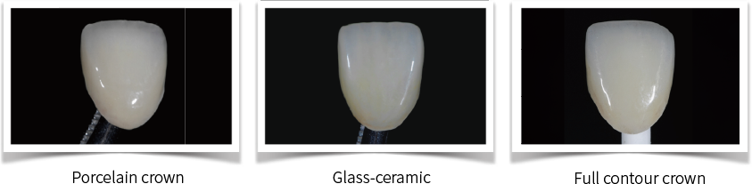 Aidite Stain/Glaze – Aidite (Qinhuangdao) Technology Co. Ltd, Keramikmassen