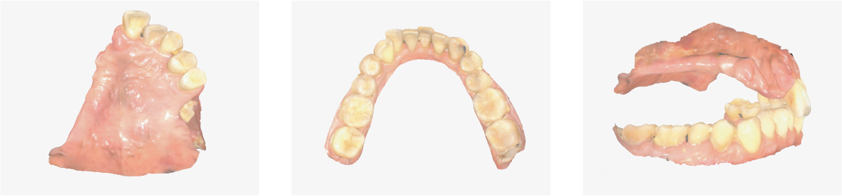 Aidite Cameo Rapid 3 – Aidite (Qinhuangdao) Technology Co. Ltd, Intraoralscanner