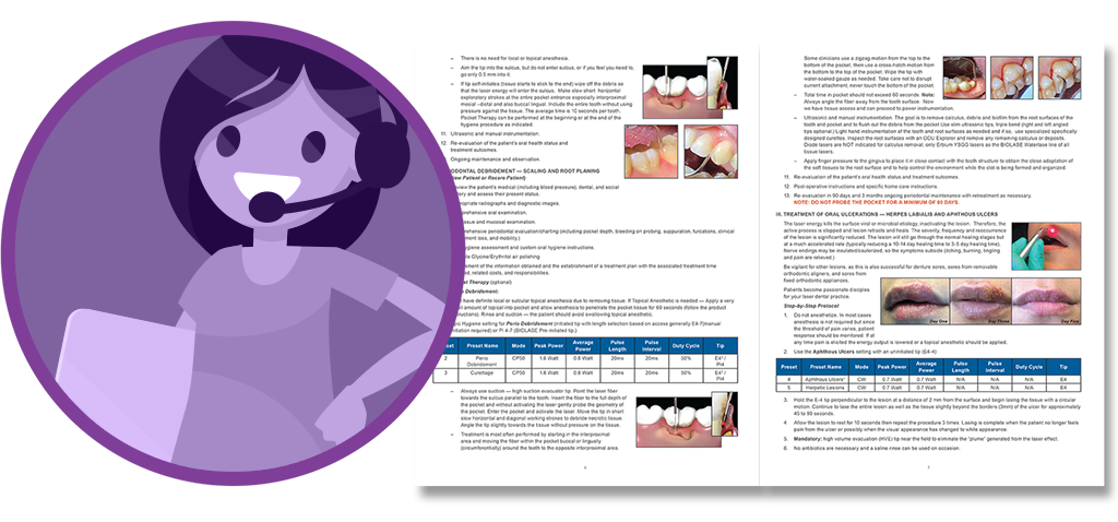 Epic Hygiene™ – Biolase Technology Inc., Geräte