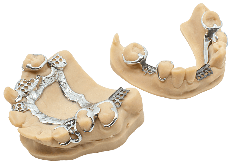 SLM Klammermodellguss – CADstar Technology GmbH, Kunststoffe