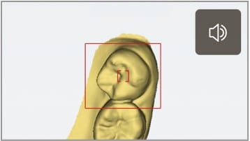 AS 100 – F1 Dentalsysteme GmbH, Intraoralscanner