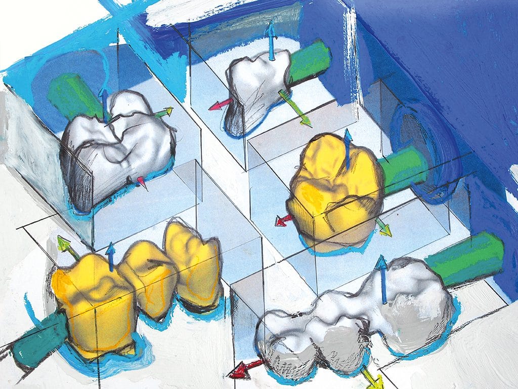hyperDENT® Practicelab – FOLLOW-ME! TECHNOLOGY, CAD/CAM-Software