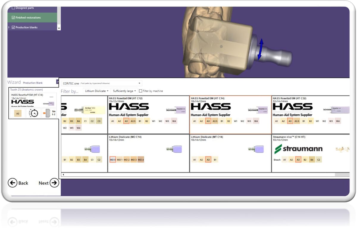 hyperDENT exocad Connect – FOLLOW-ME! TECHNOLOGY, CAD/CAM-Software