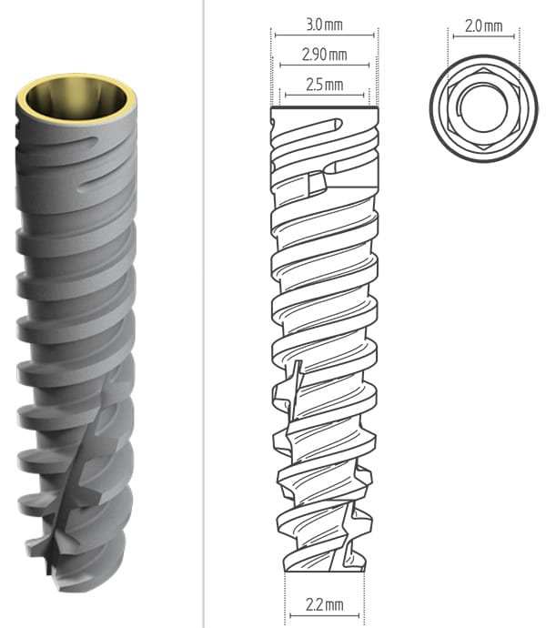 Fix Konisch ND 3.0 – Medigma Biomedical GmbH, Implantate