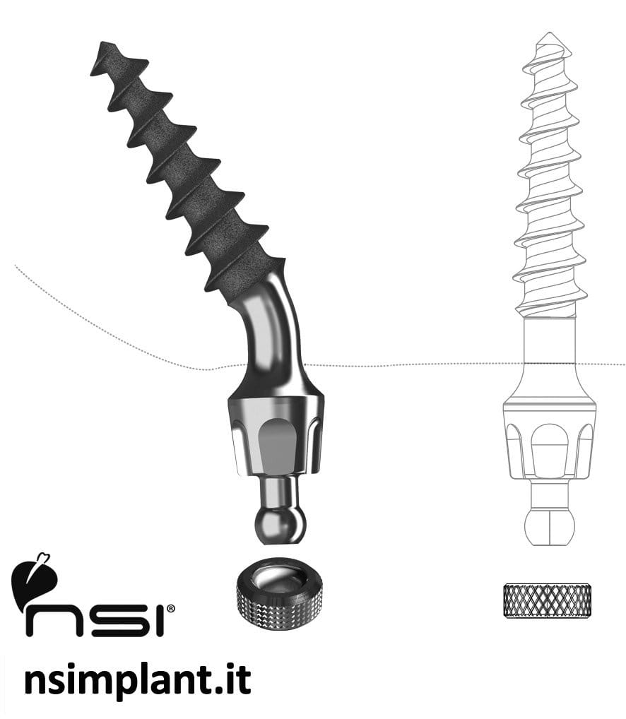 Maxifix compressive P – NSI srl, Implantate