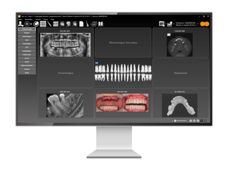 byzz® Nxt – orangedental, CAD/CAM-Software