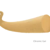 X-Gut™ Chromic Gut Resorbierbares Nahtmaterial