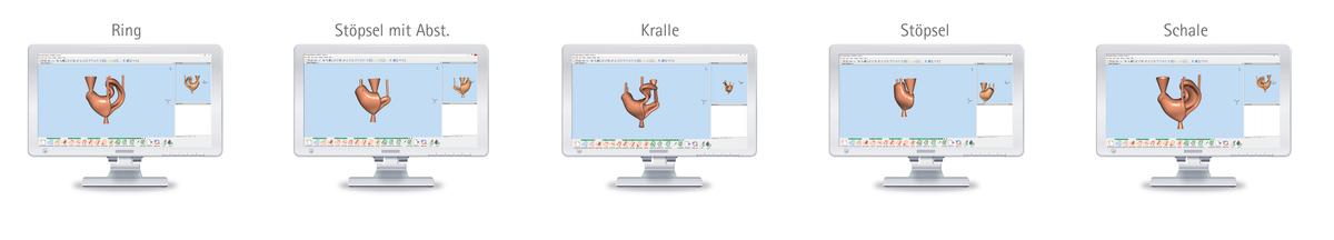 CYFEX - CAD/CAM Software für Profis – pro3dure medical, CAD/CAM-Software