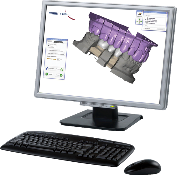 Exocad® Design Software Implant Lab Package