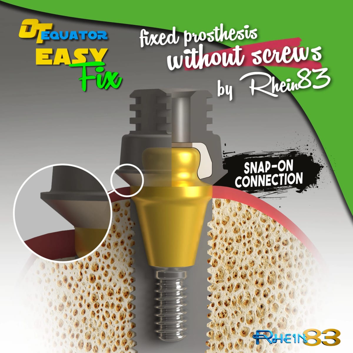 OT EQUATOR EASY FIX – Rhein 83 S.R.L., Sonstiges