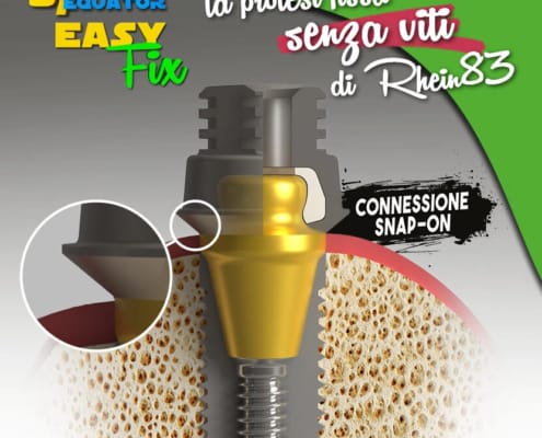 Kit All-on-Four OT Equator + Extragrade – Rhein 83 S.R.L., Sonstiges