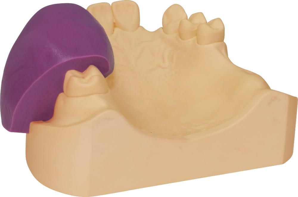 Servo-Sil 70 – Servo-Dental, Dubliermassen und Dublierküvetten