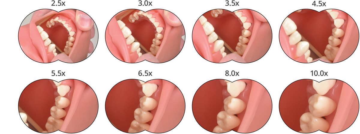UltiView™ Pro Lupenbrille – SurgiTel, Lupenbrillen und Mikroskope