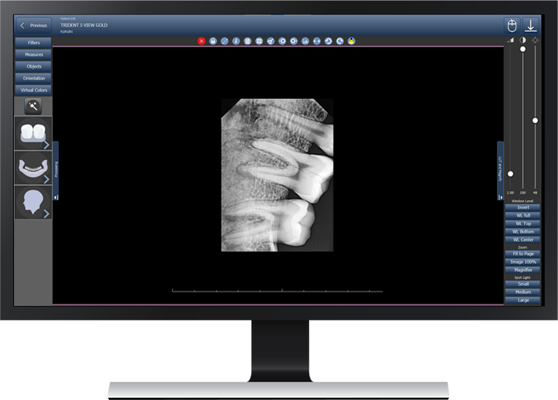 Software de imágenes dentales – Trident SRL, Röntgen