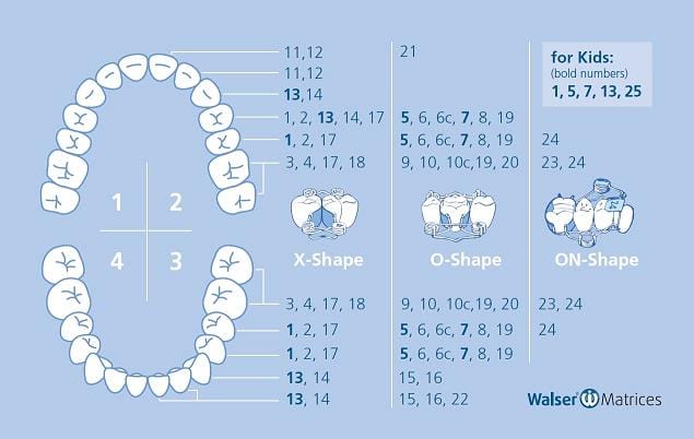 Walser Sectional Matrix System Sets – Dr. Walser Dental, Matrizen
