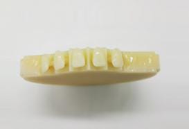Mehrschicht-Gradations-Harzdisk 3 – Chongqing Zotion Dentistry Technology Co Ltd, Blöcke