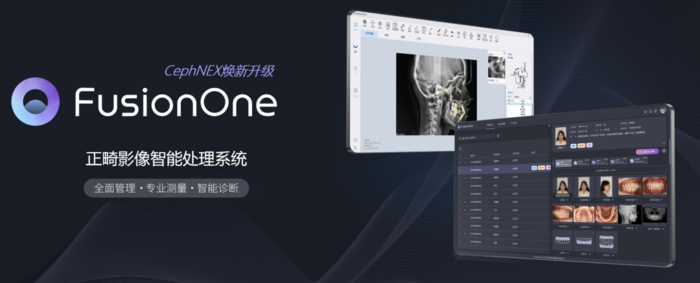 FusionOne System zur intelligenten Verarbeitung von kieferorthopädischen Bildern – LargeV Instrument Corp. Ltd., CAD/CAM-Software