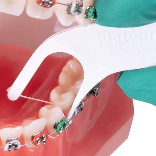 THE DYNAFLEX PLATYPUS ORTHODONTIC FLOSSER 0800-150