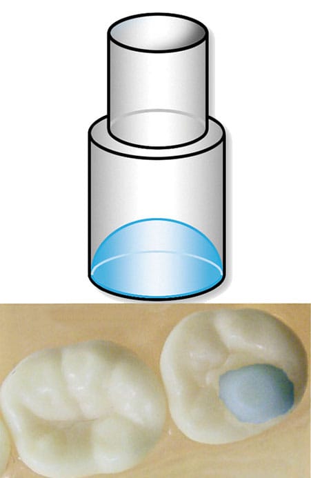 MINI MOLDS MOLAR PAD 2045-05