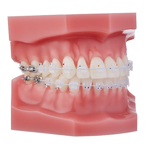 NOVA ROTH .022 5 PACK M-NCC2034