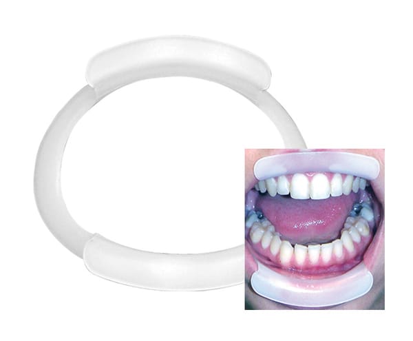 LIP RING RETRACTOR O-110-1059