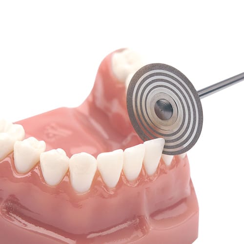 DYNAFLEX ORTHO STRIPPING DISC – Dynaflex Orthodontics USA, Polierscheiben und -streifen