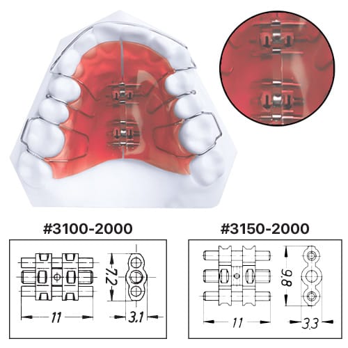 EXPANSION SCREWS 3100-2000