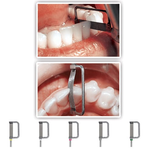 DYNAFLEX RECIPROCATING IPR SYSTEM - DOUBLE SIDED