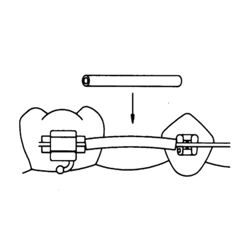 ARCHWIRE SLEEVES & BUMPER TUBING PO-901-1203 – Dynaflex Orthodontics USA, Sonstige Drahtelemente