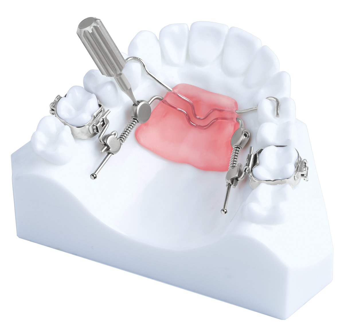 SmartJet – Dynaflex Orthodontics USA, Klasse-II-Apparaturen