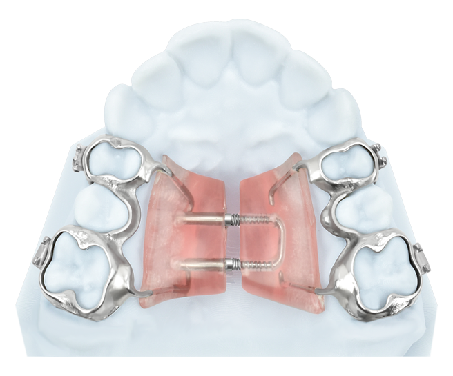 Series 2000 Appliances – Dynaflex Orthodontics USA, Sonstige Schienen