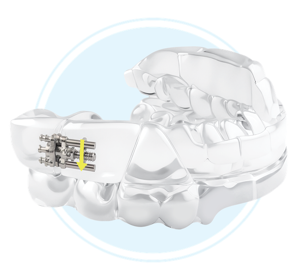 DynaFlex Dorsal