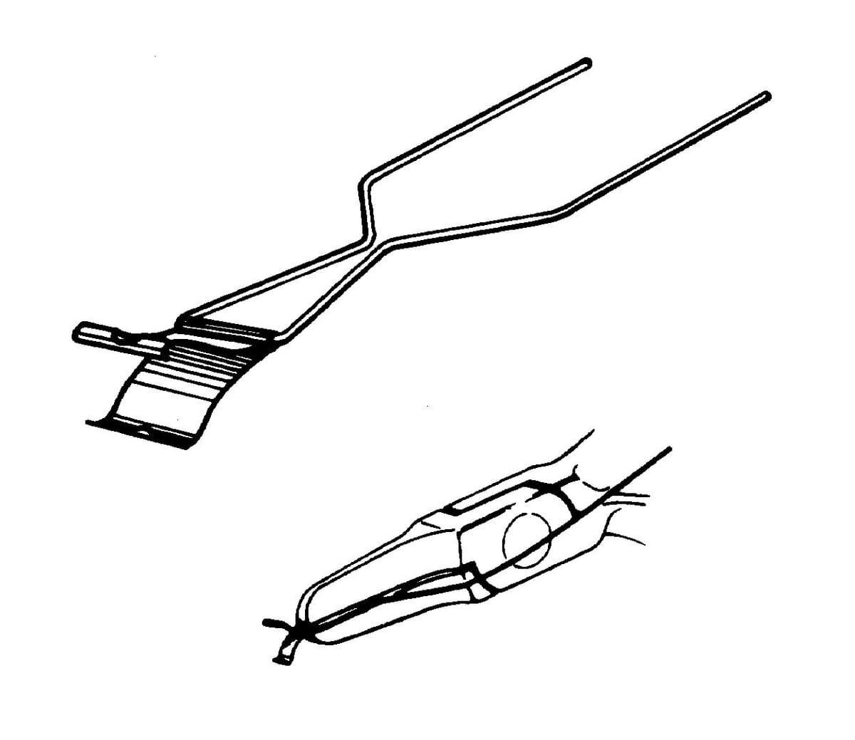 3M™ Unitek™ Steiner Rotationsfeder Keil 7000024865 – Solventum, Verbindungselemente