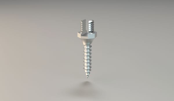 Pasin-Pin® – BBC-Orthotec GmbH, Verankerungssysteme