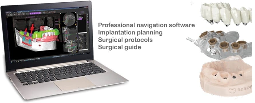 B&B Dental GS – B&B Dental SRL, CAD/CAM-Software