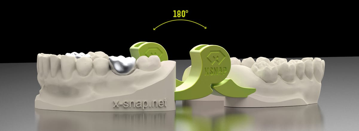 xSNAP 360 – H&L GmbH Hofmann und Löwe Qualitätsicherung GmbH, Gipszusätze, Stumpflacke und Gipslöser