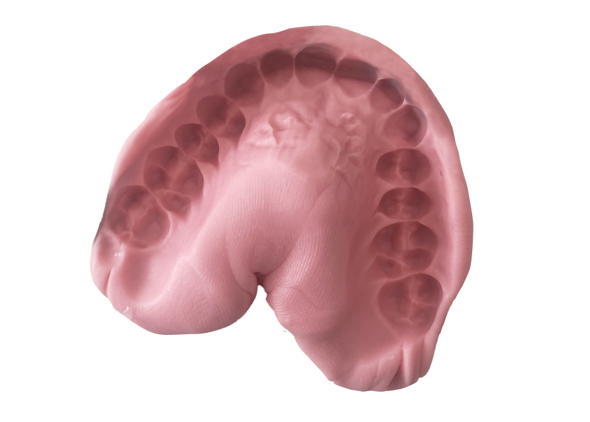 Vinylbest 4.187 – BMS Dental S.r.l., A-Silikone