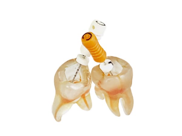 Endo Training Tooth – Bondent GmbH, Zubehör für Wurzelbehandlung
