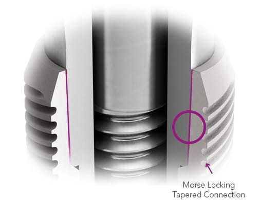 CONICAL IMPLANT – Brat Implants, Implantologie