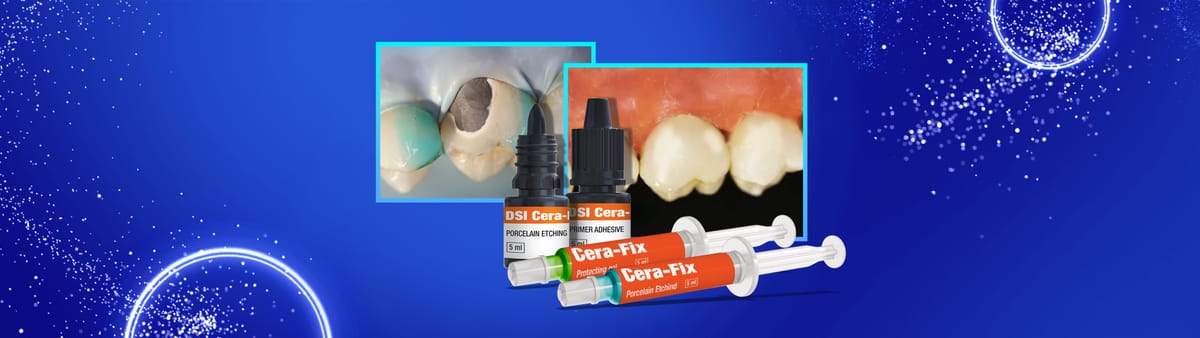 DSI Cera-Fix Repair Kit – DSI Dental Solutions Ltd, Zemente