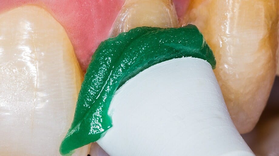 Flairesse Paste, 1 Tube à 75 ml, Melone grob 220425 – DMG, Zahnreinigungs-Polierpasten und Zubehör