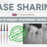D-Shaper – Shenzhen Denco Medical Co., Ltd, Wurzelbehandlung