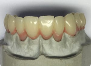 Flexistrong Plus – DentalPlus, Sonstige Zahntechnikmaterialien