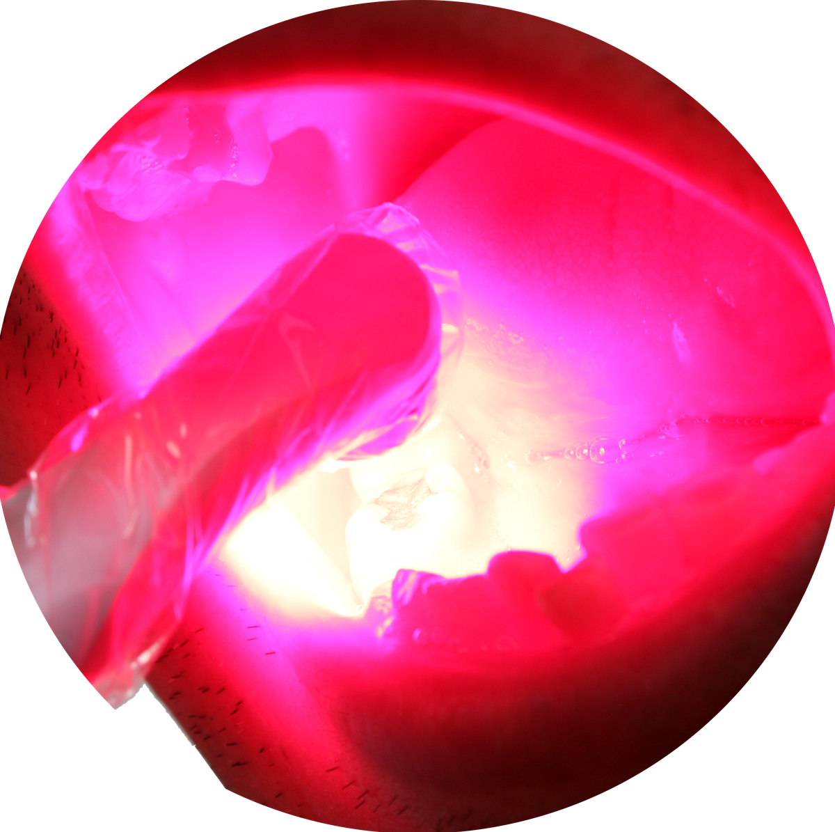FUSION PBM Light – DentLight Inc., Geräte