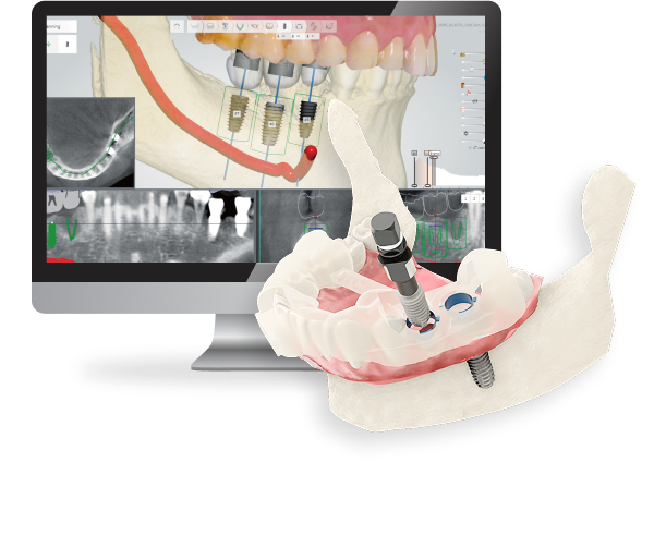 DIO NAVI – DIO IMPLANT, Geräte