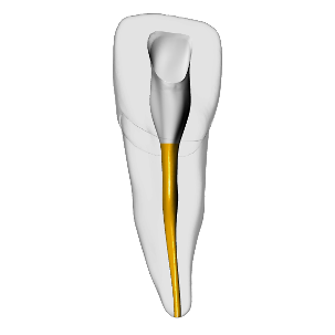 Incisor – Gutta percha, Clear – DRSK Group AB, Zubehör für Wurzelbehandlung