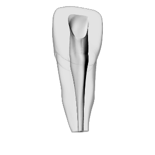 Incisor – Accessed, Narrow open apex – DRSK Group AB, Zubehör für Wurzelbehandlung